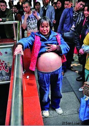 因湊不齊治大肚病的5萬元,她只能強忍病痛。(網友供圖)圖片來源:重慶晨報 因湊不齊治大肚病的5萬元,她只能強忍病痛。(網友供圖)圖片來源:重慶晨報