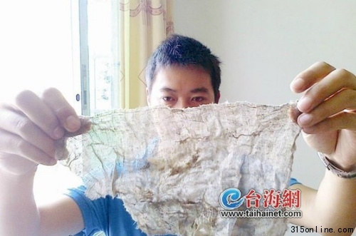 女子產子后體內遺留紗布醫院稱系操作失誤所致