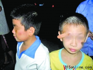 8歲學(xué)生稱遭老師扇耳光致眉角開(kāi)裂皮肉外翻(圖)