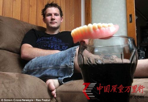 現(xiàn)在,年僅25歲的肯維爾已經(jīng)戴上了假牙。(資料圖片)